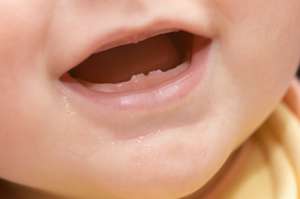 آلام التسنين - هل يسبب ظهور الأسنان الألم للطفل الرضيع
