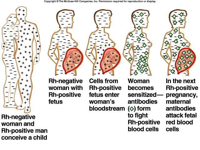 اختلاف الزمرة الدموية بين الزوجين و انحلال دم الجنين و المولود