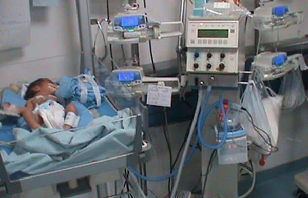 جهاز التنفس الصناعي أو الاصطناعي أو الآلي للأطفال و الرضع