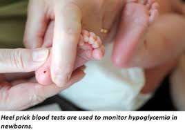 نقص و هبوط سكر الدم عند الطفل حديث الولادة