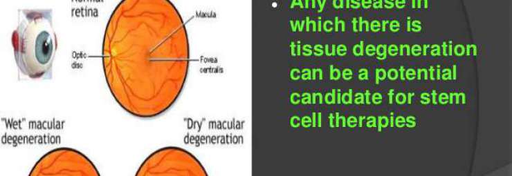 الأمراض التي يمكن علاجها بالخلايا الجذعية