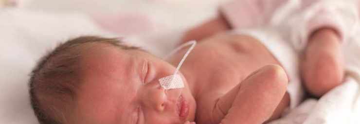 تشخيص داء الأغشية الهلامية عند طفل حديث الولادة