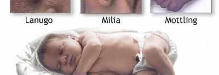 جلد الاطفال حديثي الولادة