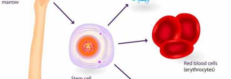 علاج متلازمة ايفانز بزرع الخلايا الجذعية