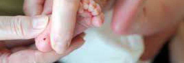 نقص و هبوط سكر الدم عند الطفل حديث الولادة