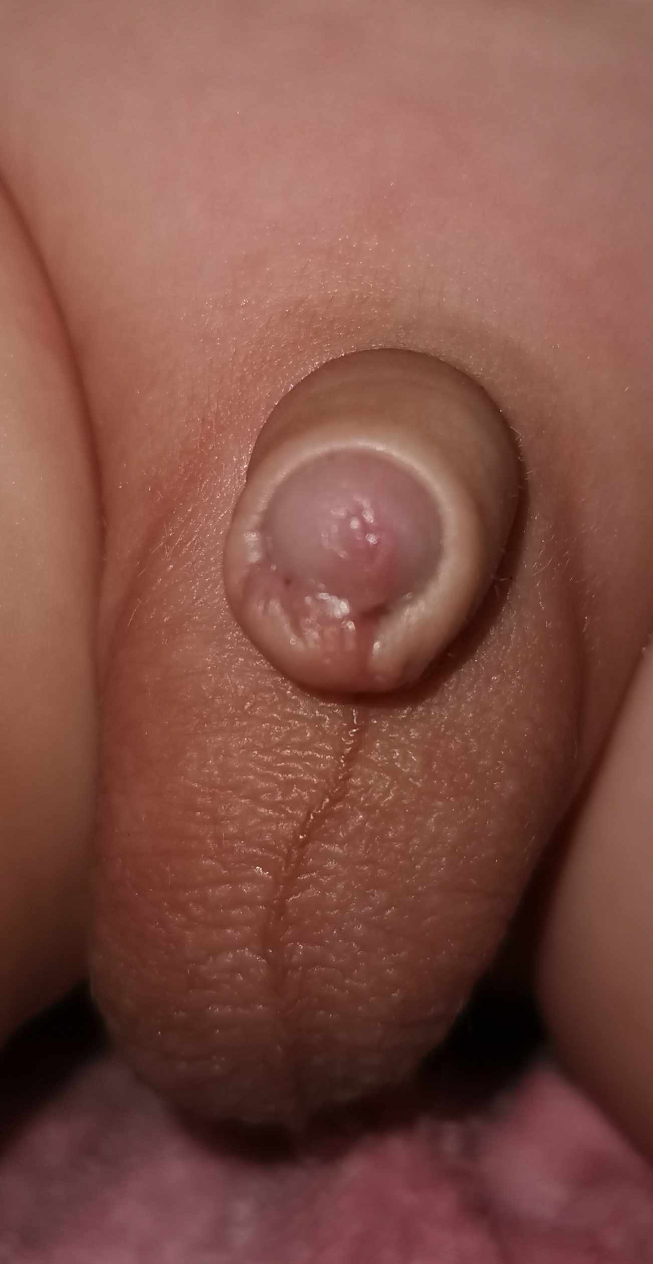 هل يجب اعادة الطهور مرة اخرى؟