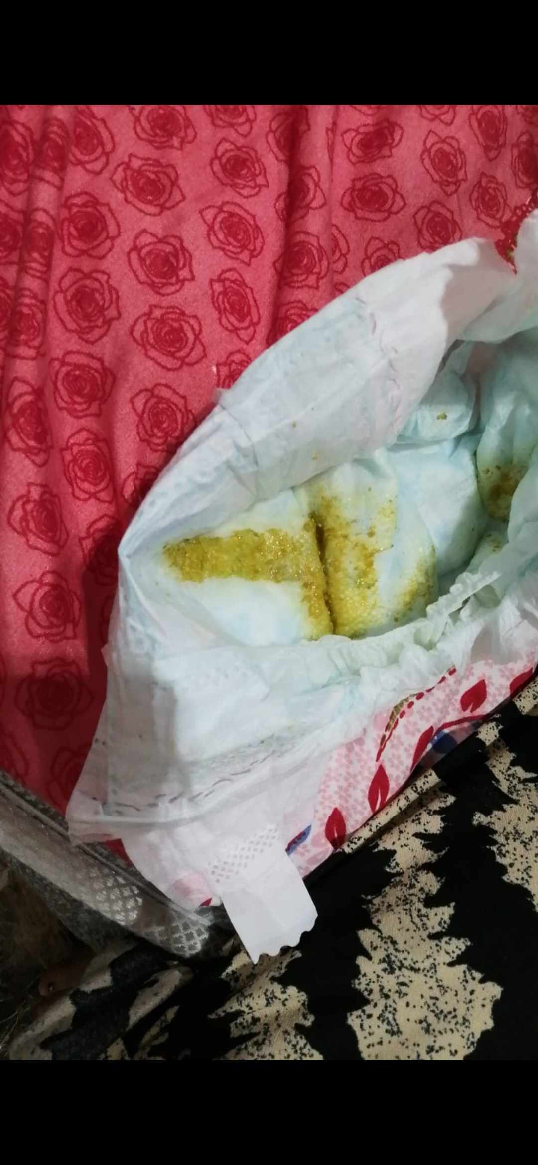 متى يكون الإسهال مقلق عند الأطفال؟