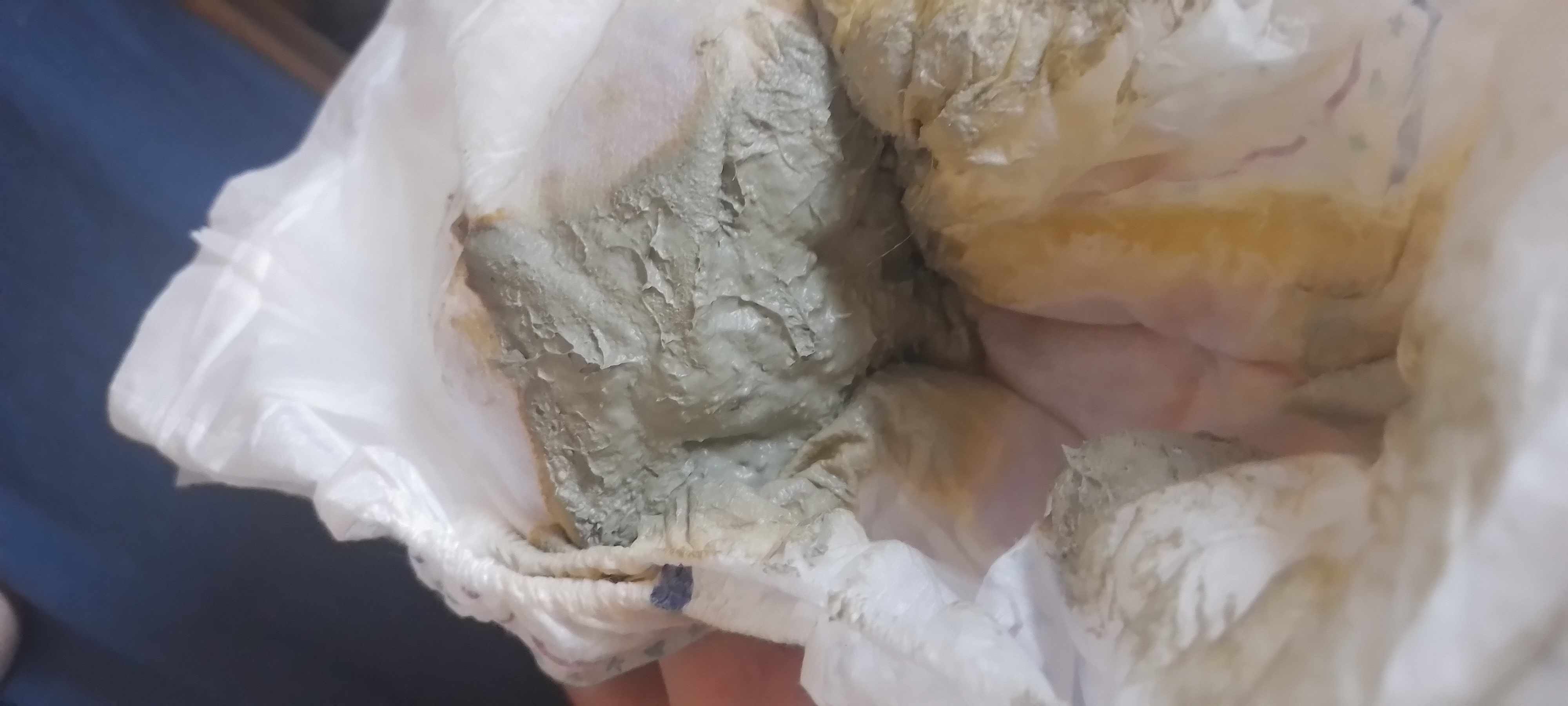 ما سبب لون البراز الرمادي للطفل الرضيع