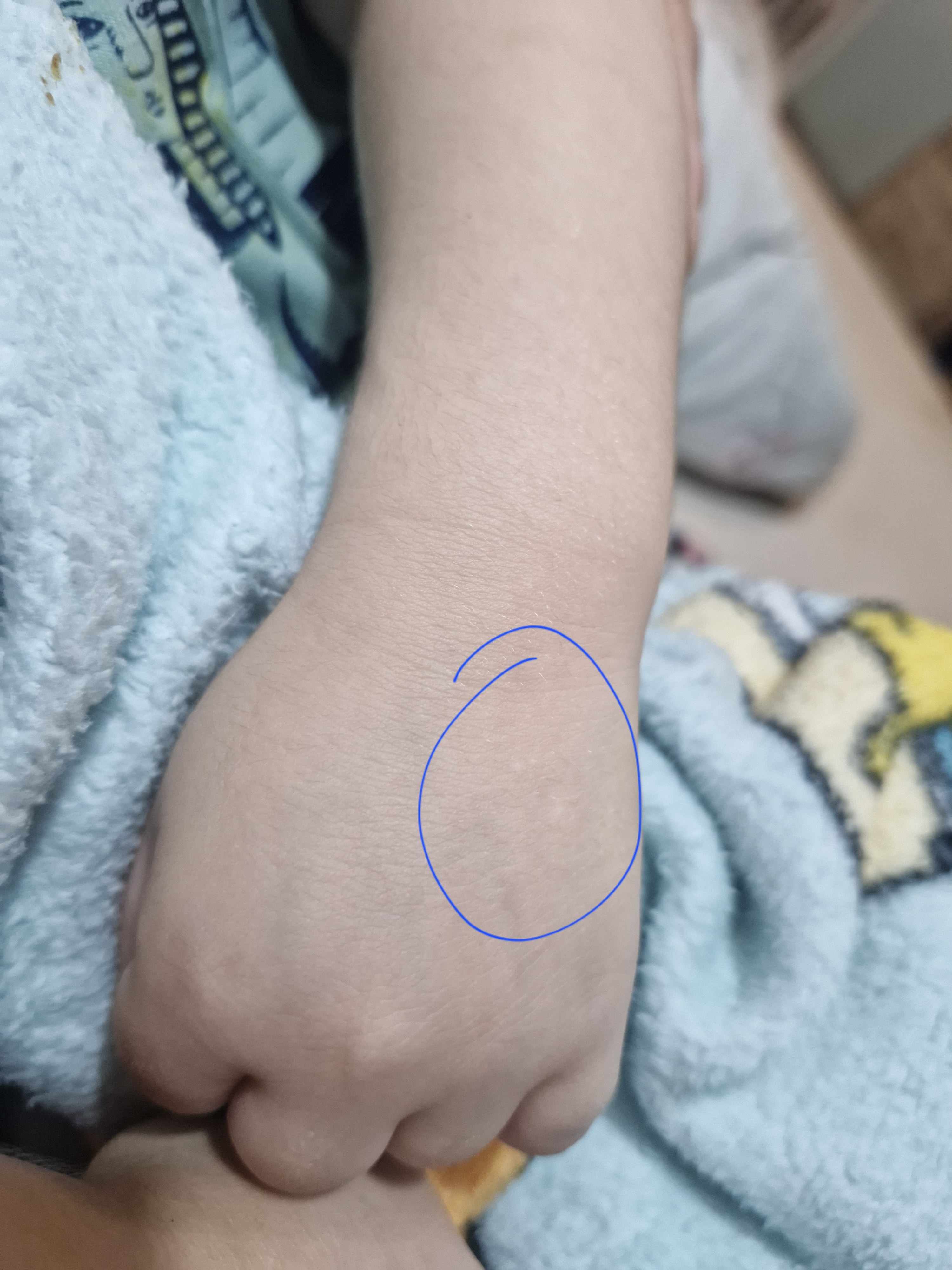هل آثار الخدوش تختفي مع الوقت؟