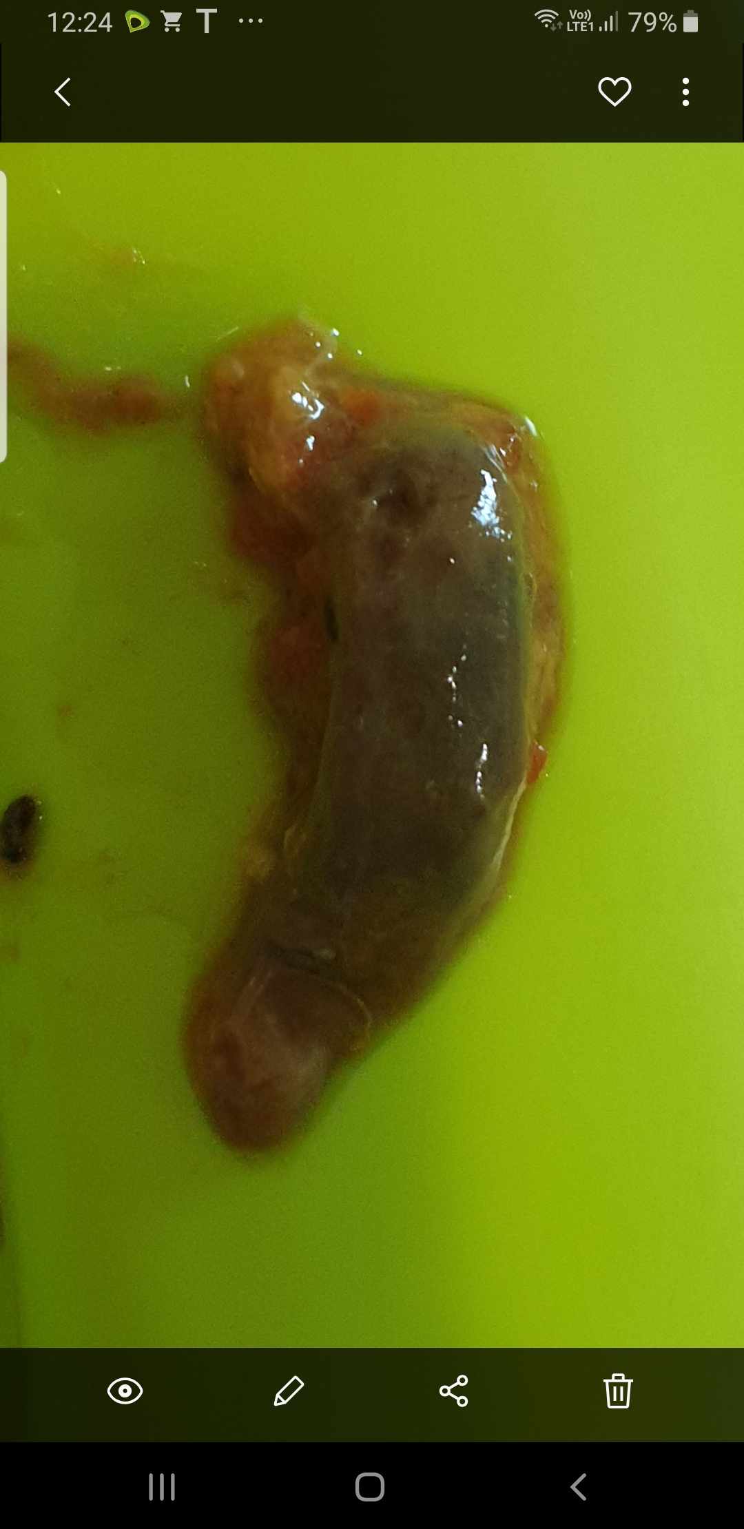 اسهال الطفل فيه مواد غريبة