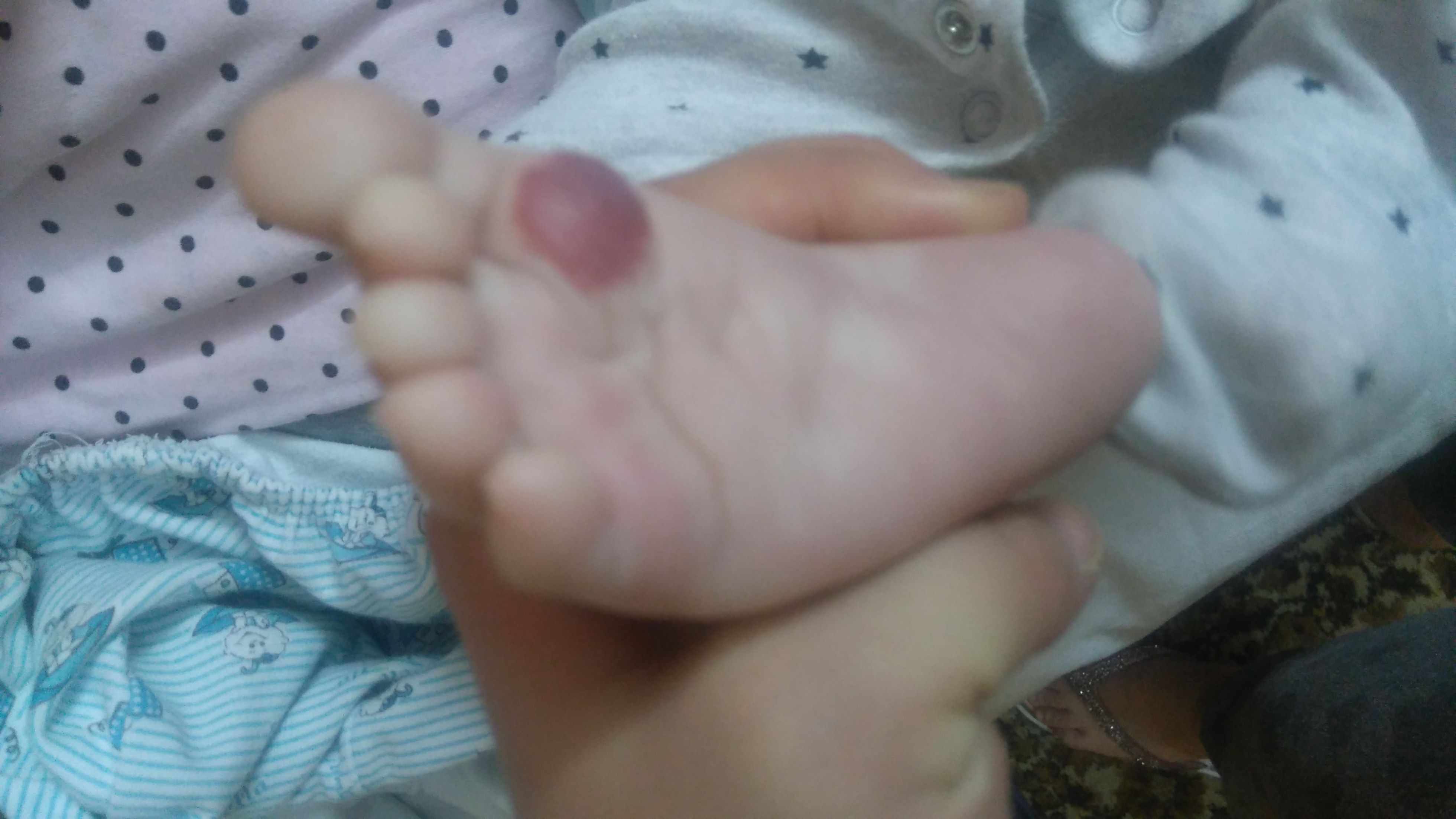 تجمع اوعية دموية