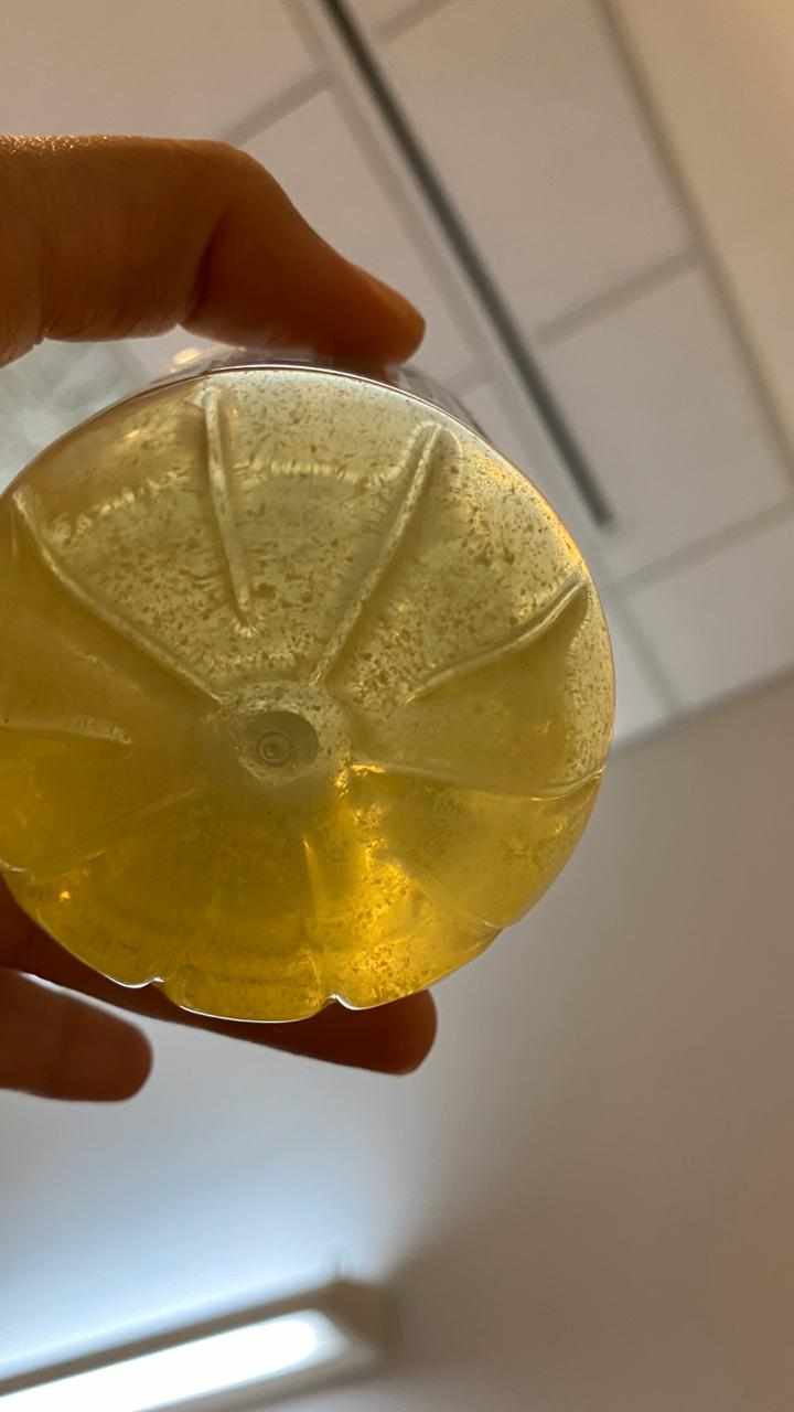سبب نزول إفرازات بيضاء مع البول