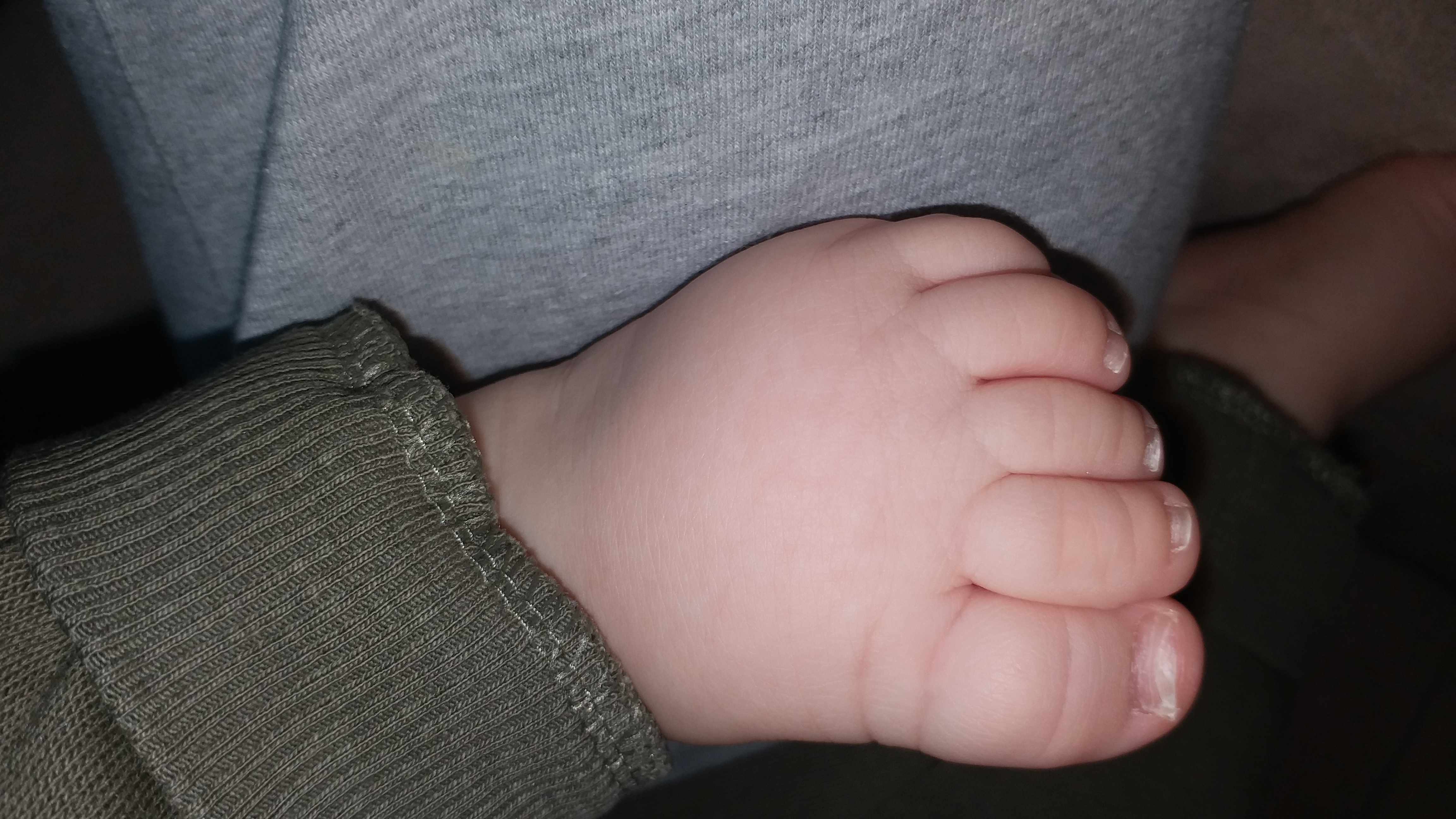 اظافر قدمي طفلي غريبة الشكل