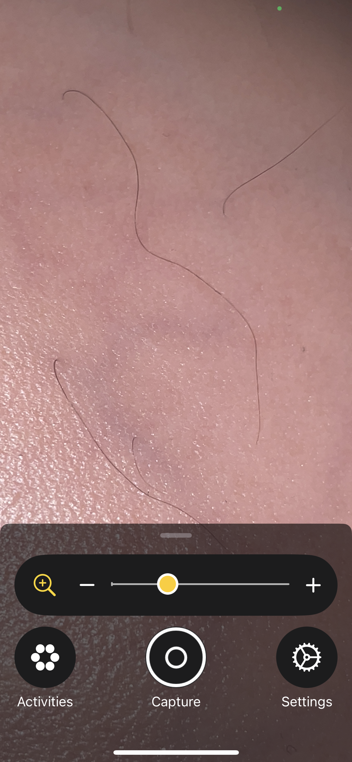 ما هي أسباب ولادة الطفل بدون شعر؟