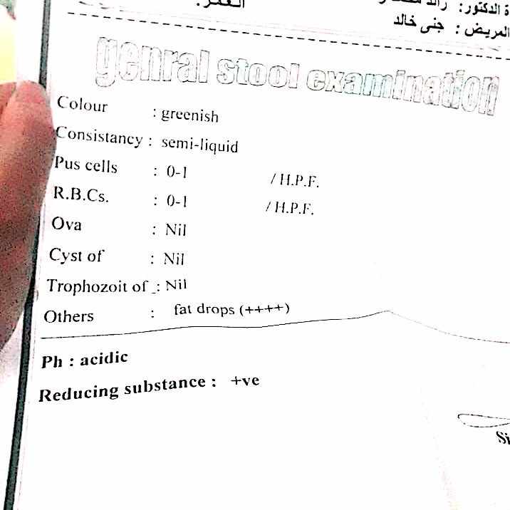 دهون و دسم البراز +++