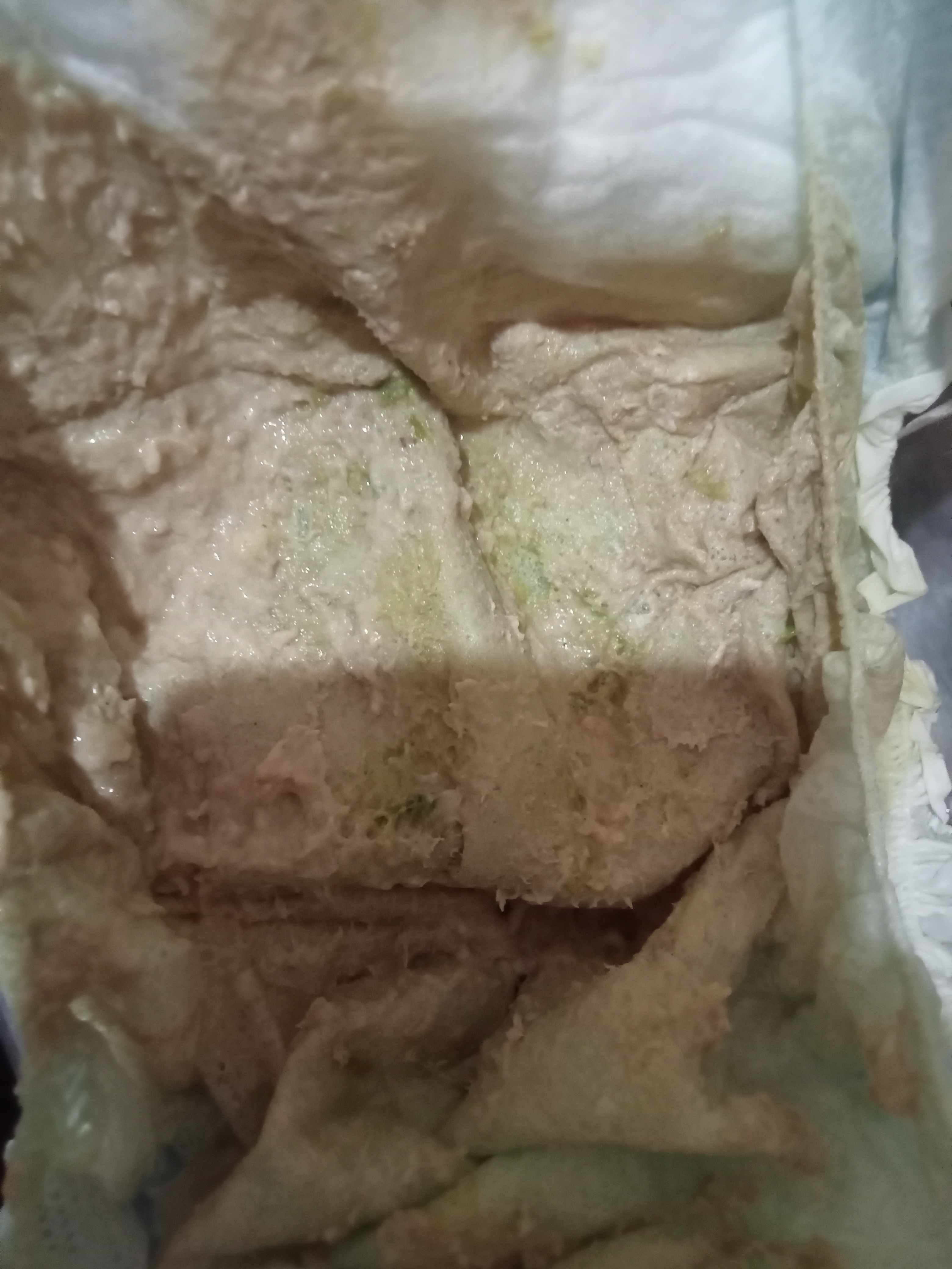 لون براز طفلي فاتح