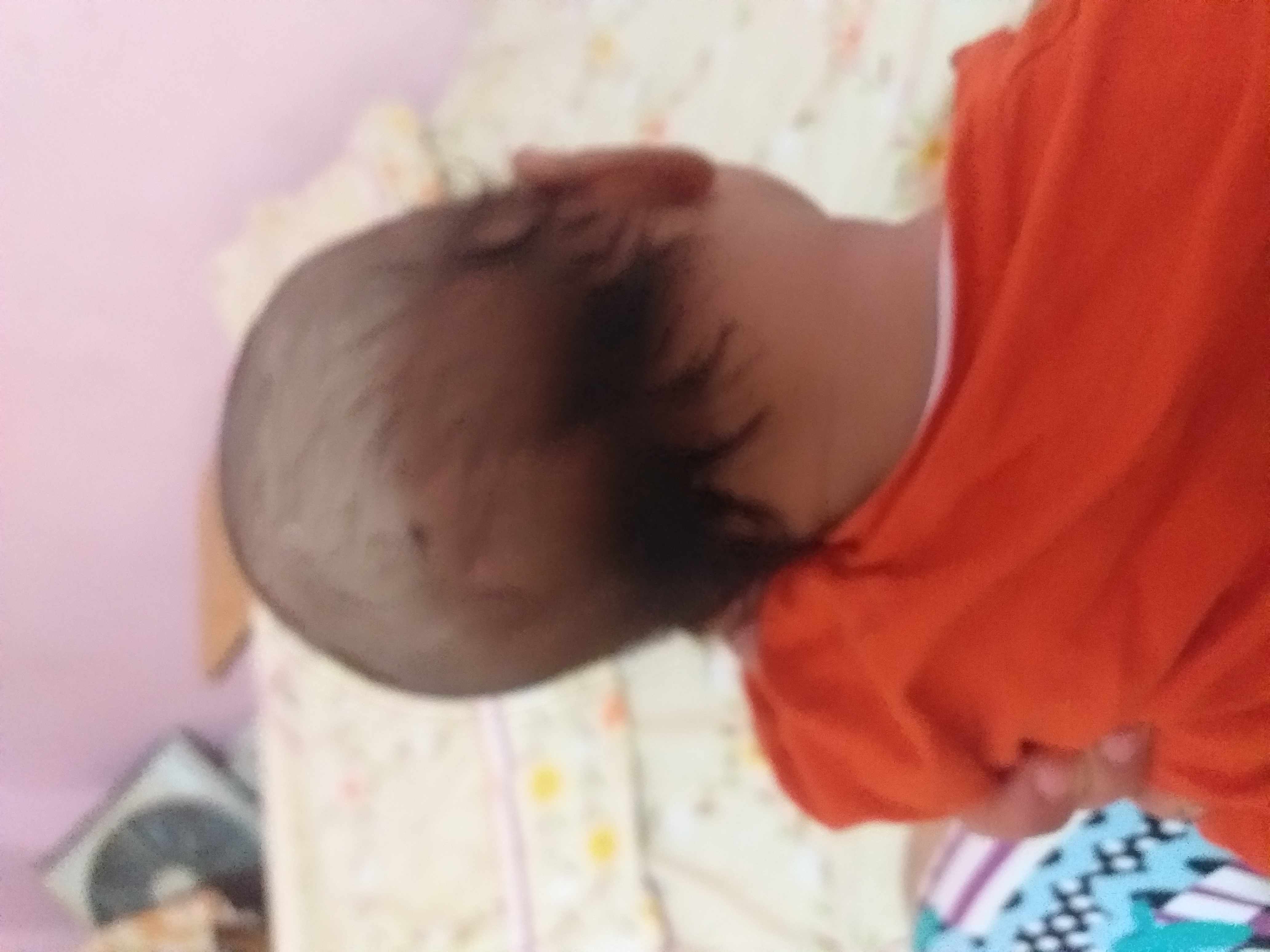 راس طفلى مسطحه
