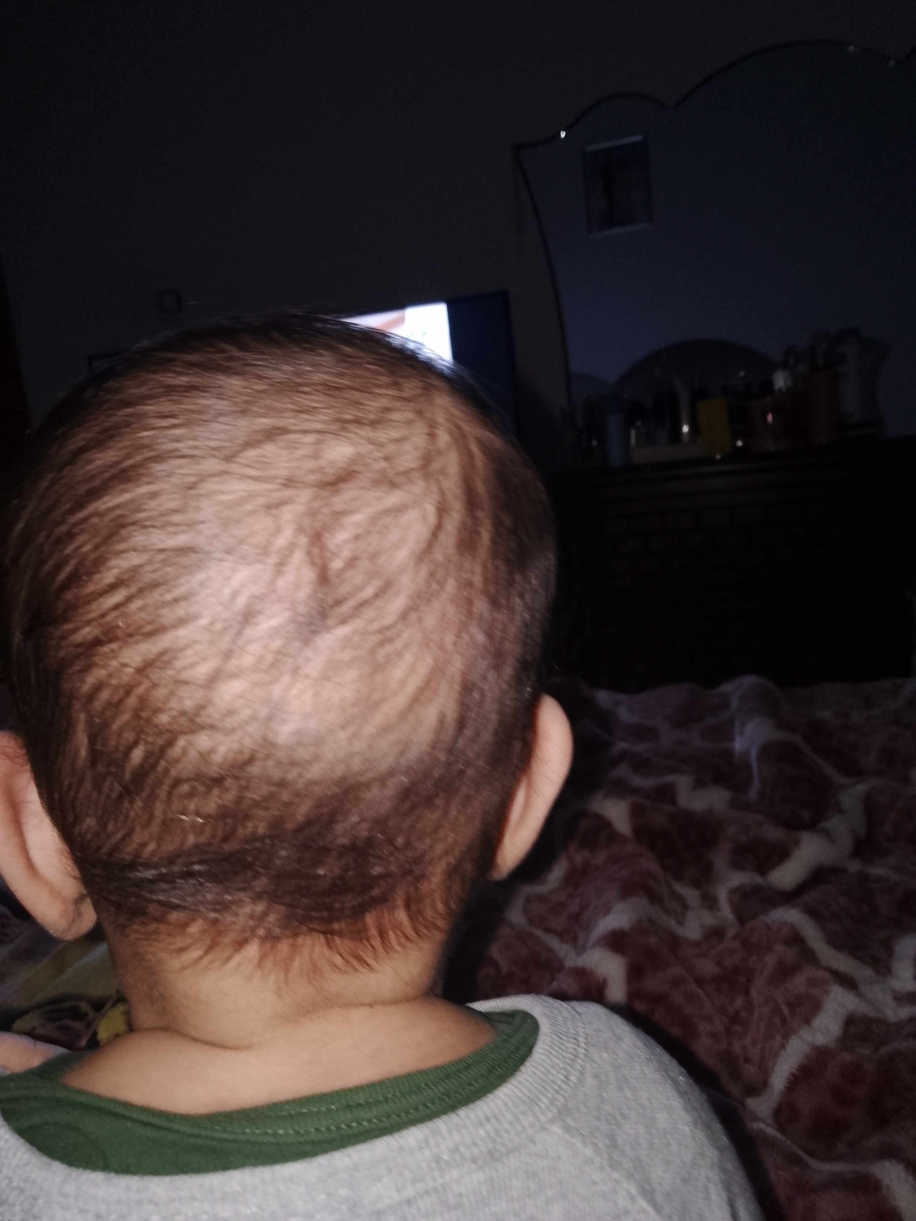 ابني ضرب راسو من ورا