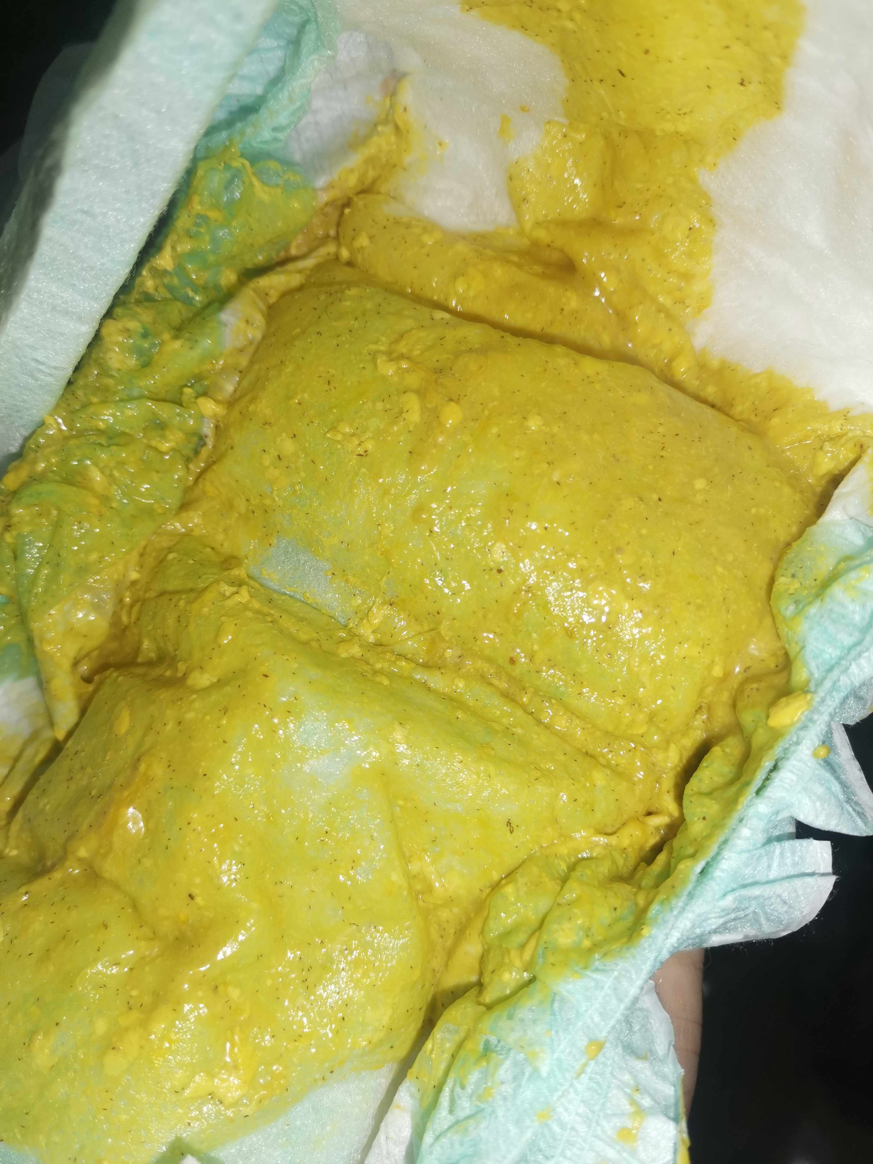 ما سبب وجود حبات سوداء كثيرة في البراز مثل الفلفل الأسود المطحون؟