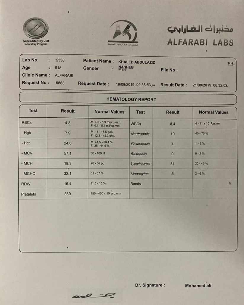 الترحيل الكهربائي للهيموجلوبين