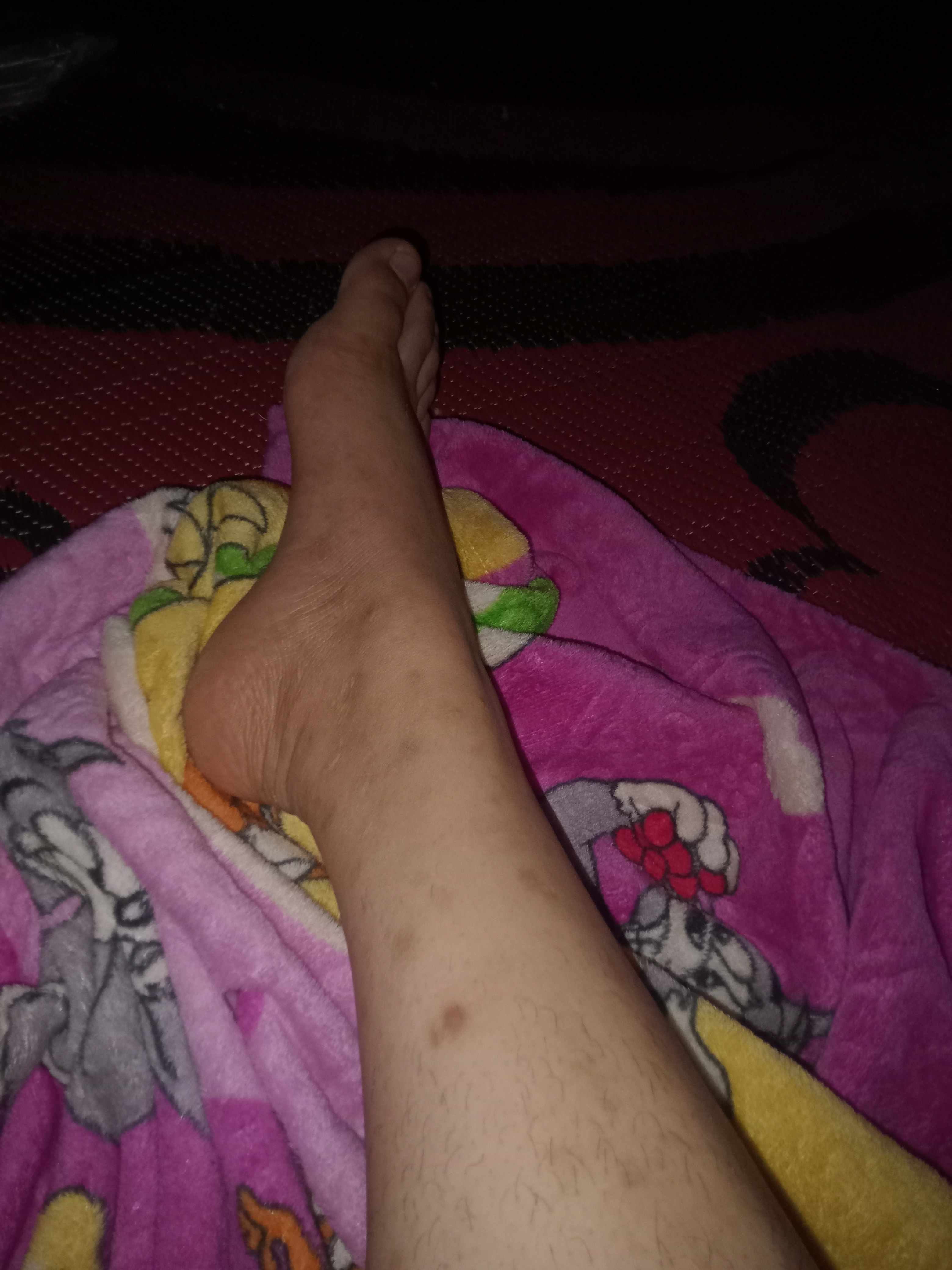 حبوب بنية في الساقين