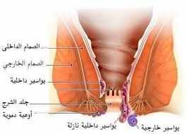 كيف اعرف ان طفلي مصاب بالبواسير؟