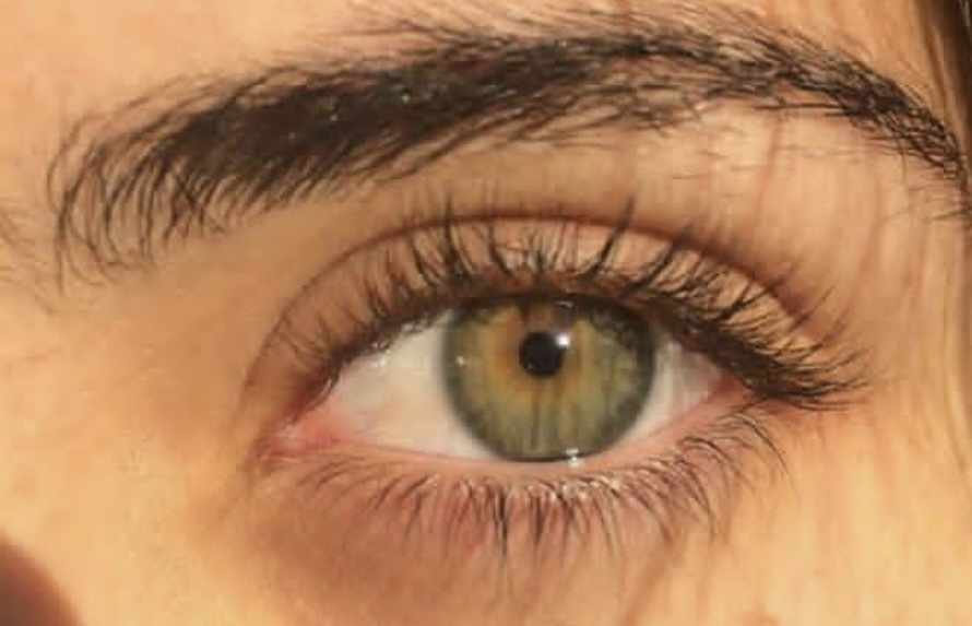 بياض العين غير صافي: 4 أسباب