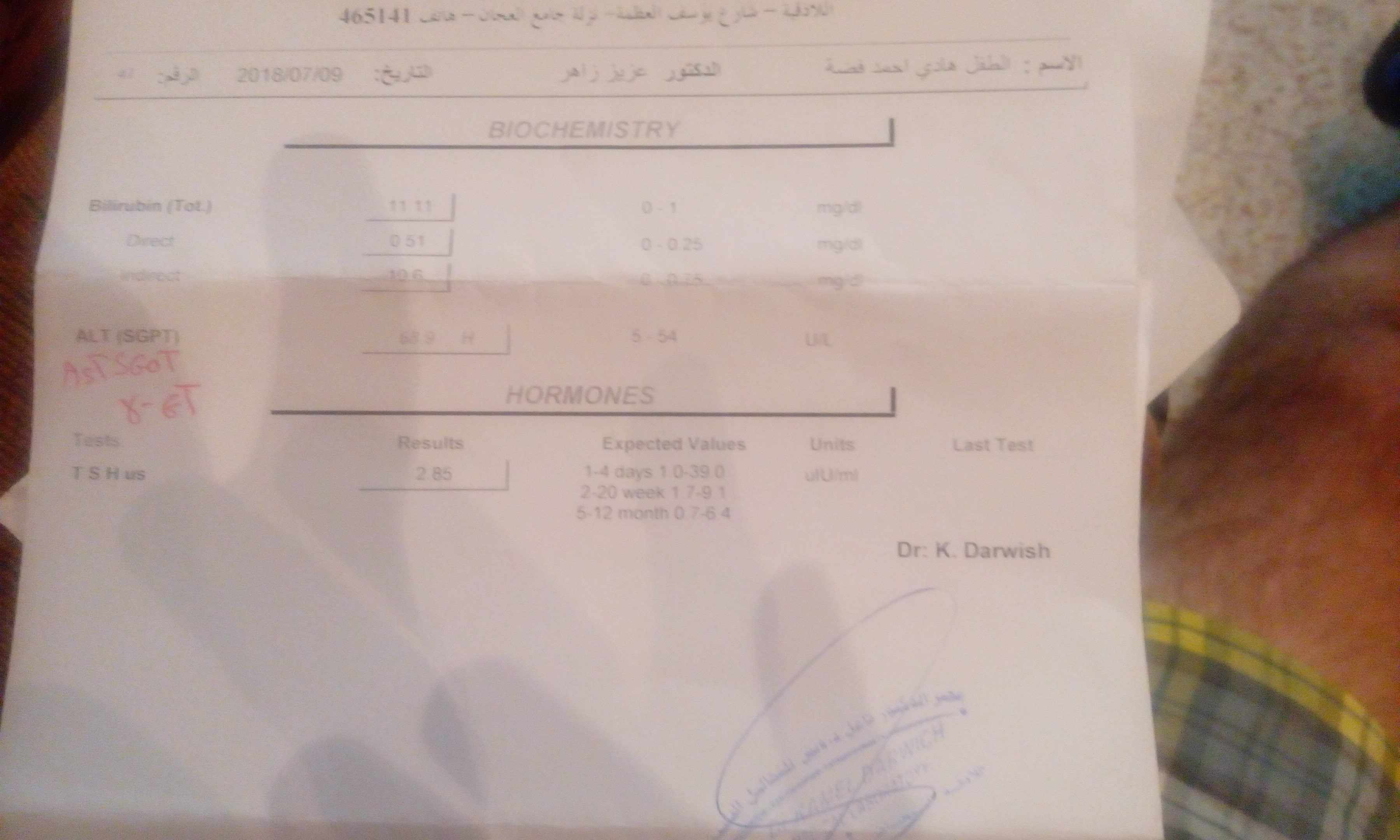 نسبة البيلوروبين عالية بعمر شهر