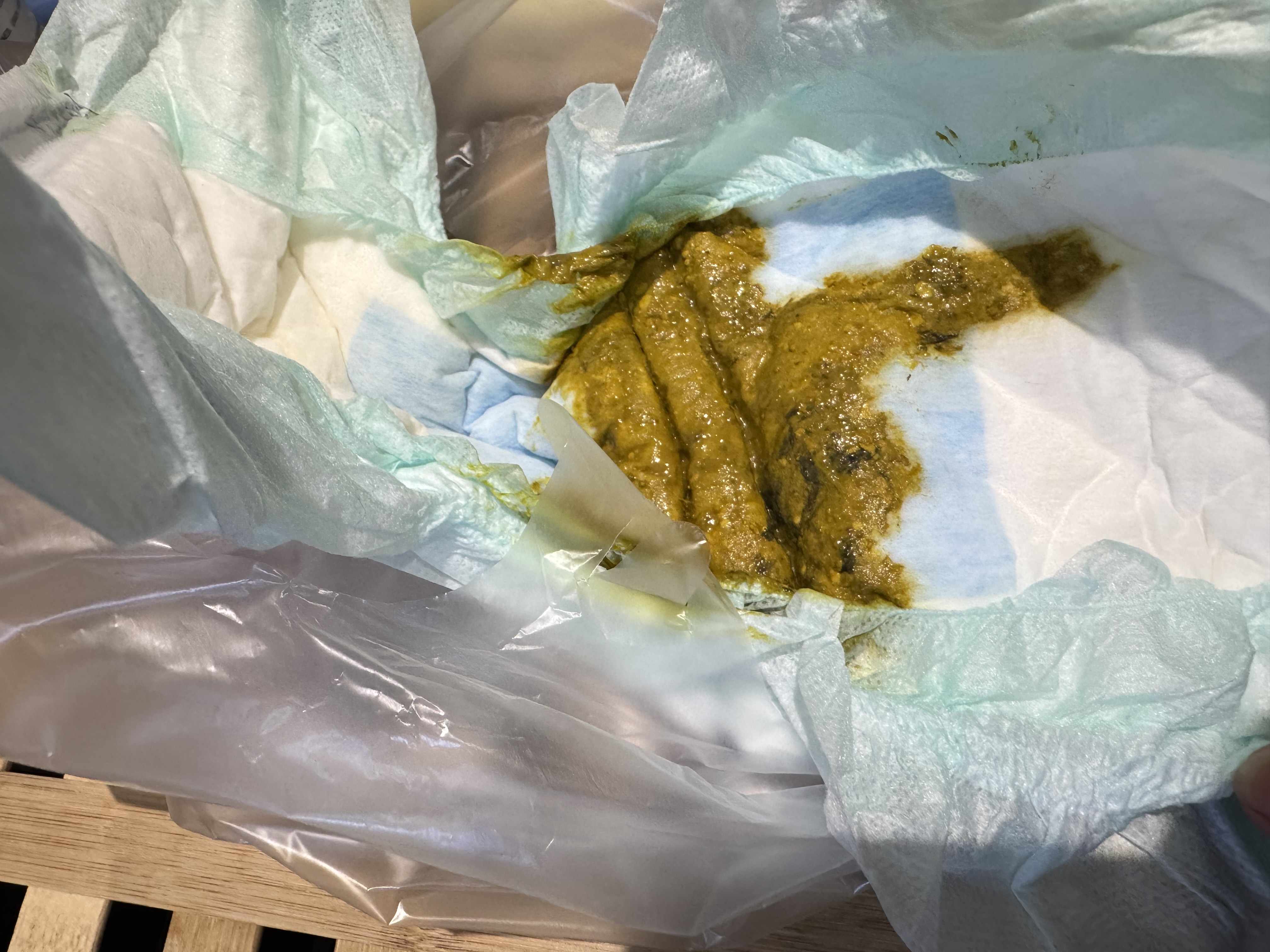 ظهور اللون الأسود في براز الرضيع