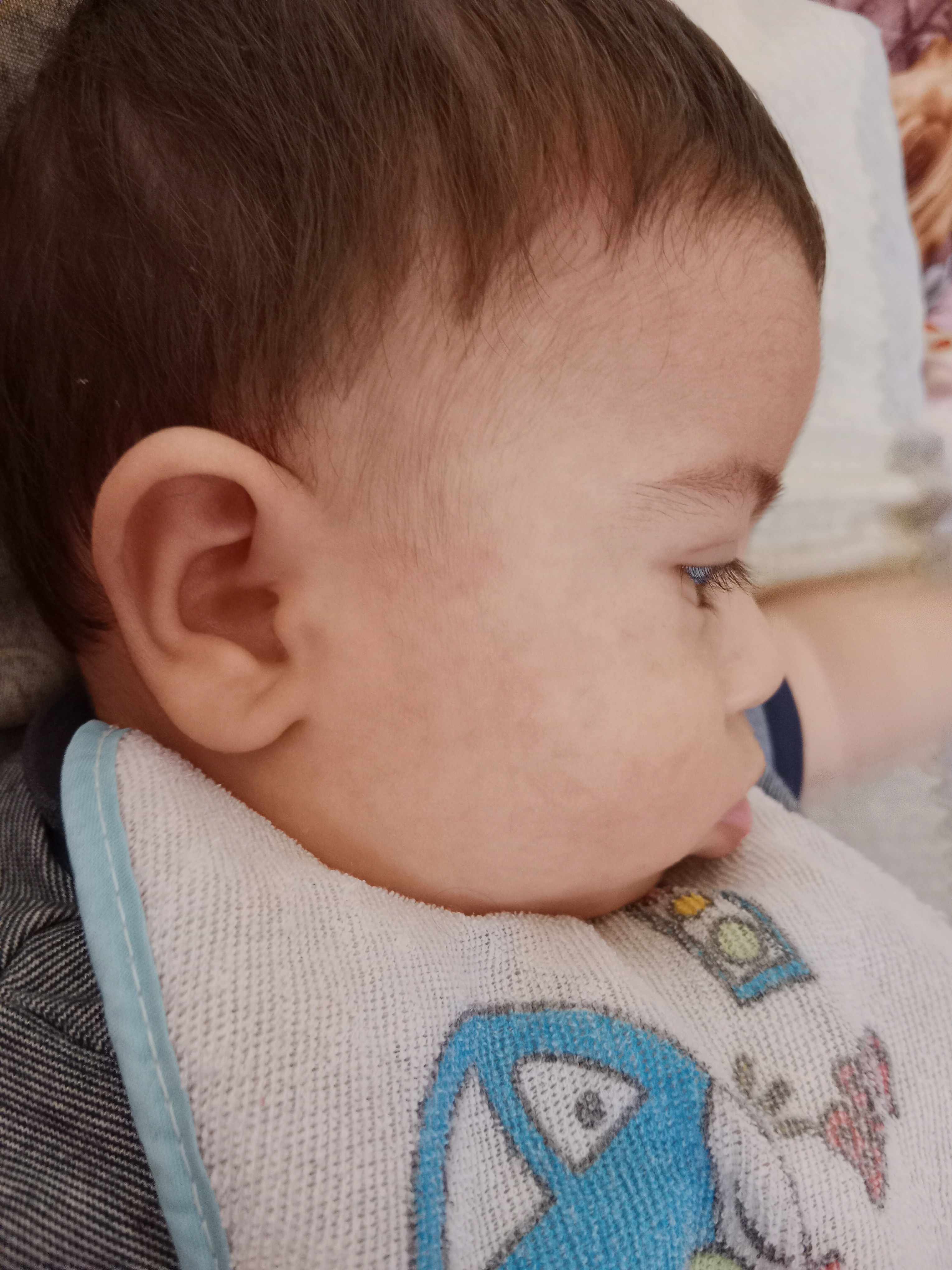 طفح جلدي بعد ادخال الطعام للرضع