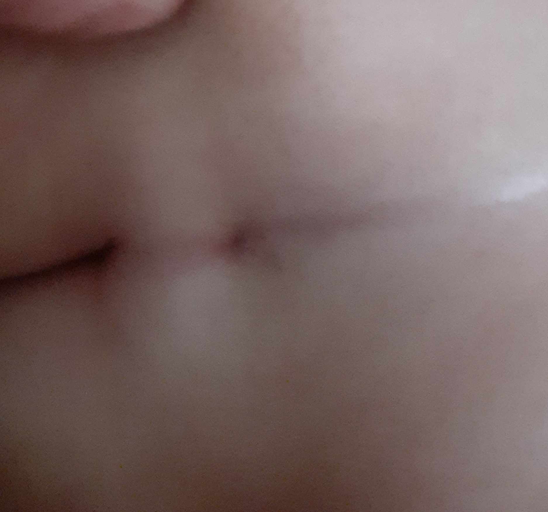 أسباب سيكرل دمبل