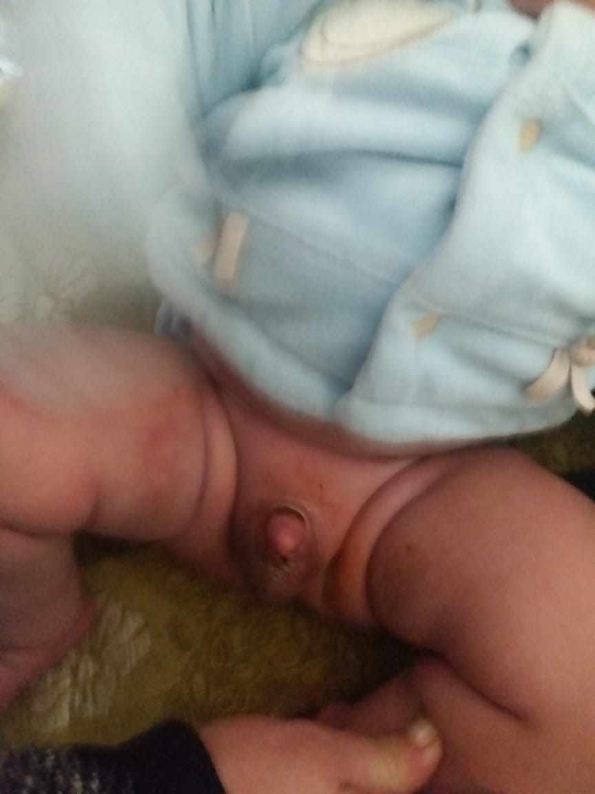الختان و الطهور مرتين