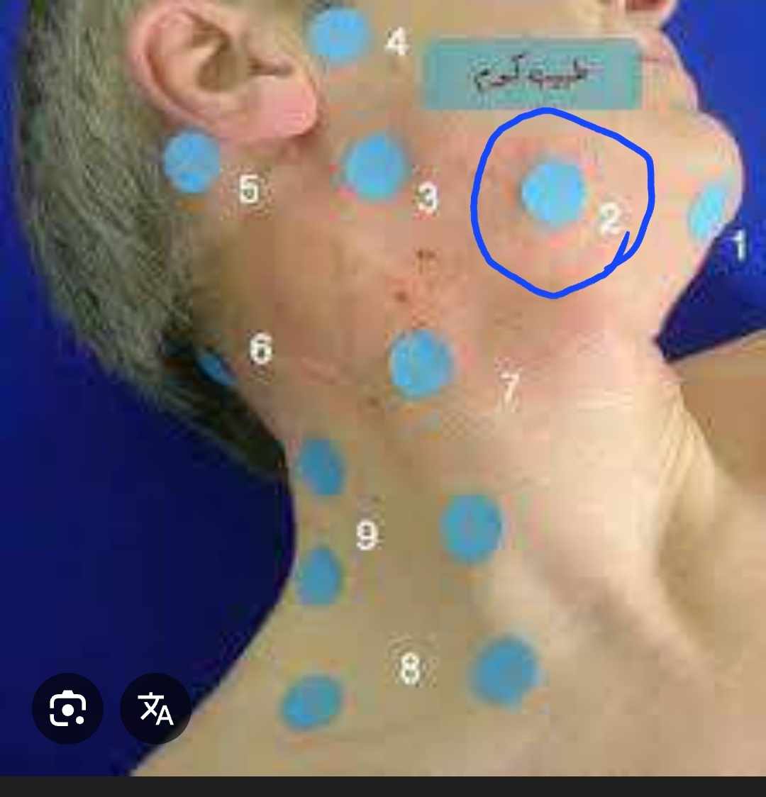 غدة لمفاوية بحجم حبة الحمص عند الطفل