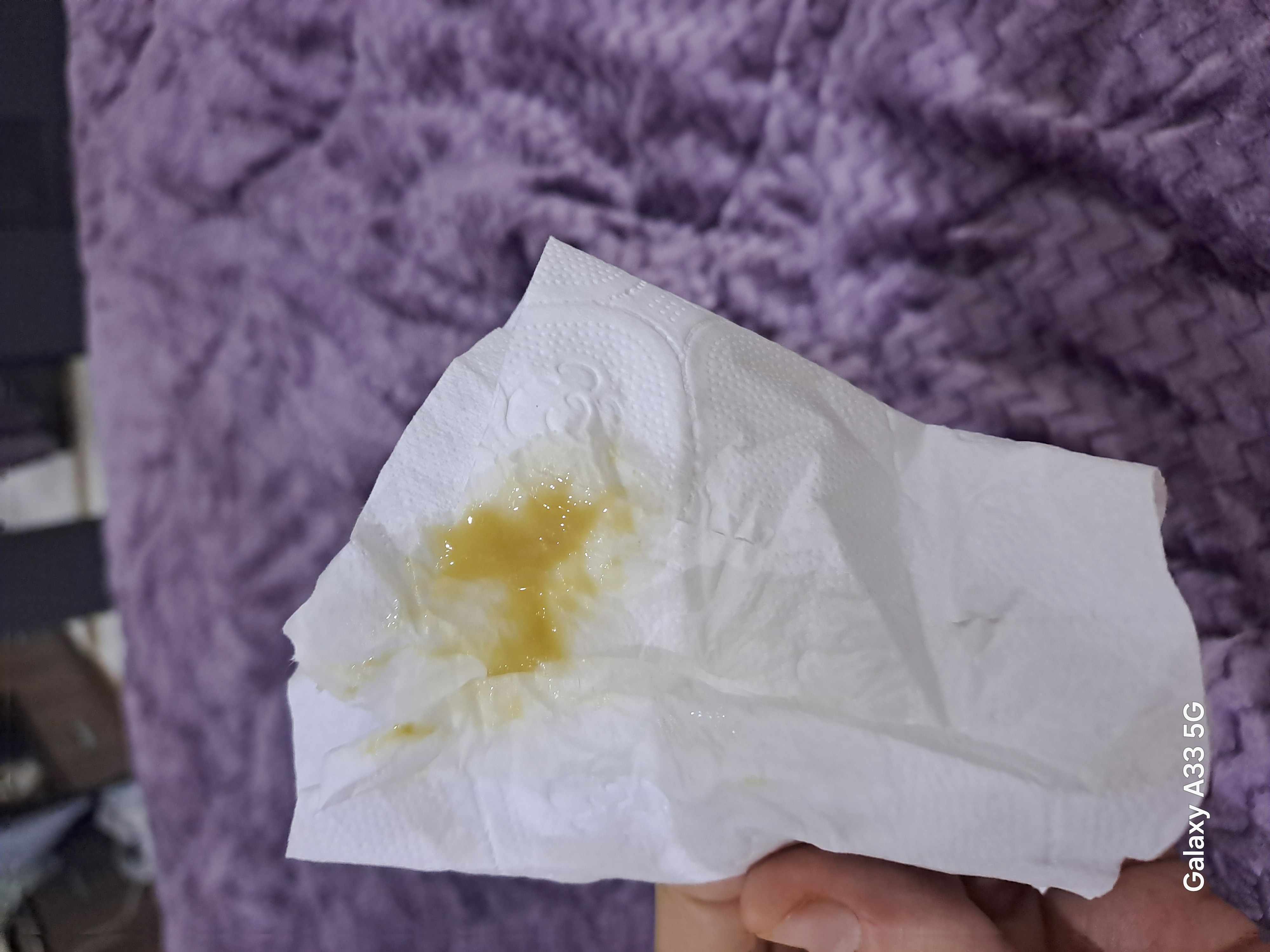 افرازات برتقالية ثخينة من فتحة الانف من شهر