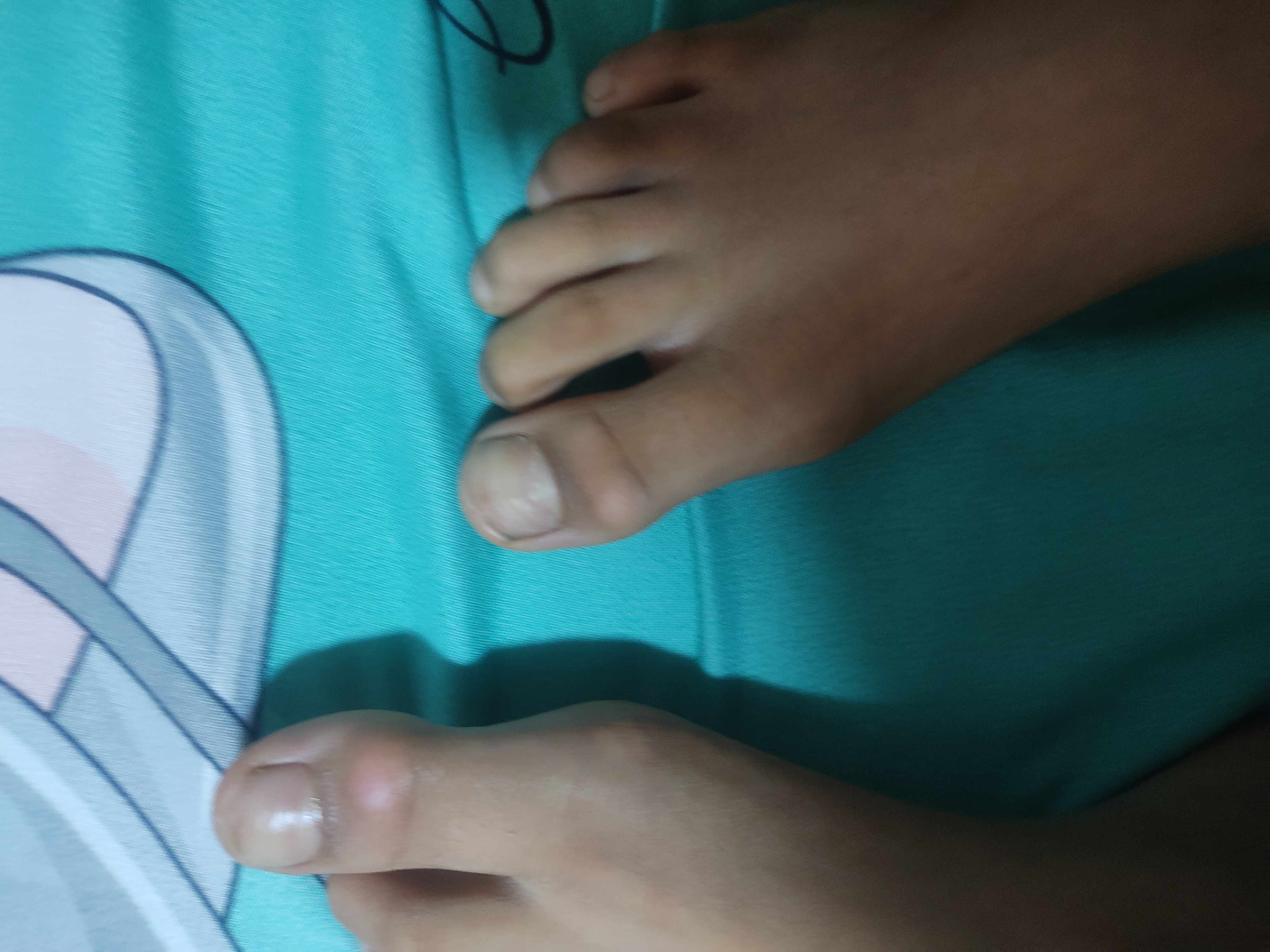 اسباب ثني اصابع القدم؟