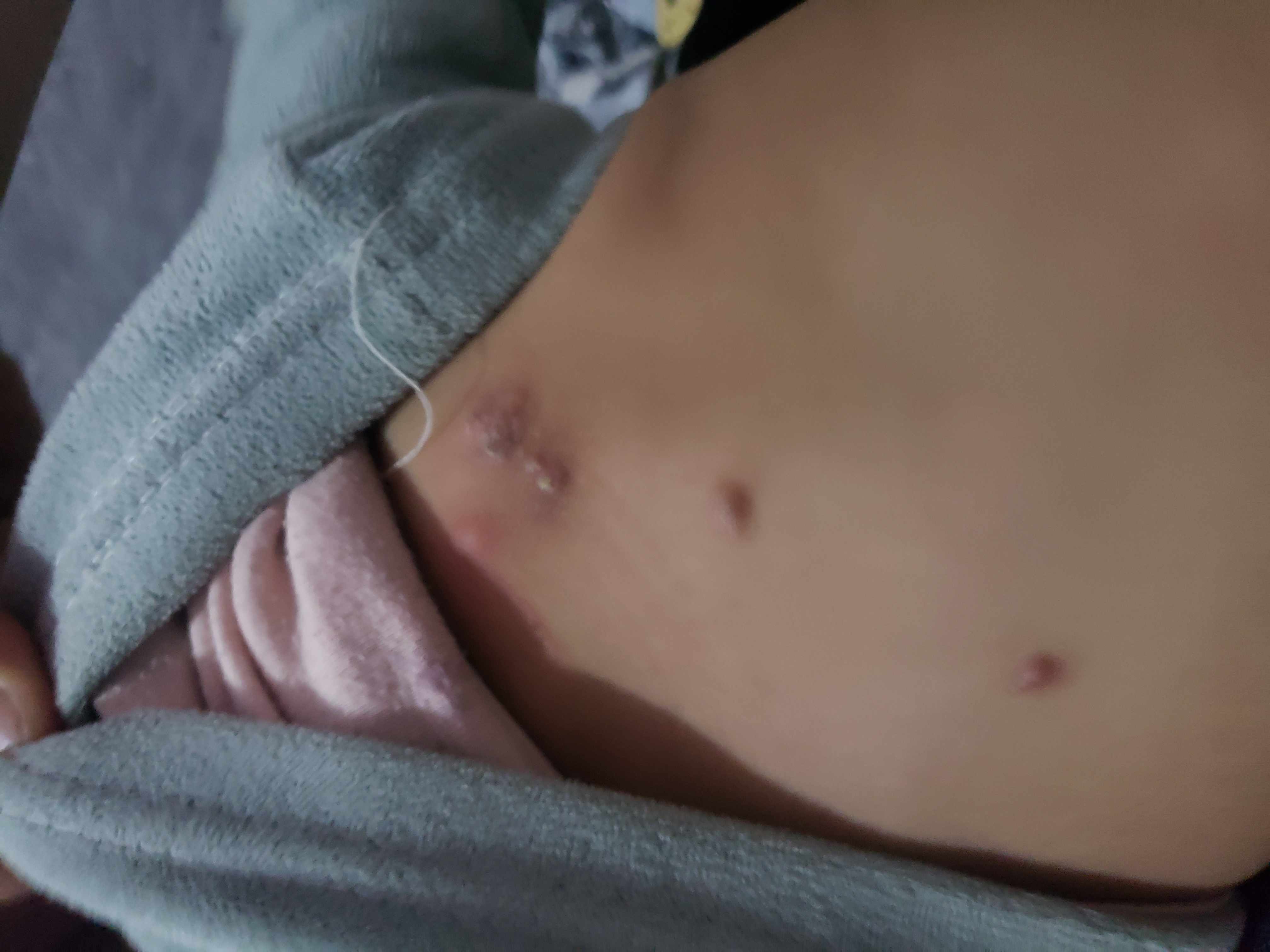 ما هي أسباب ظهور حبوب حمراء فيها ماء؟