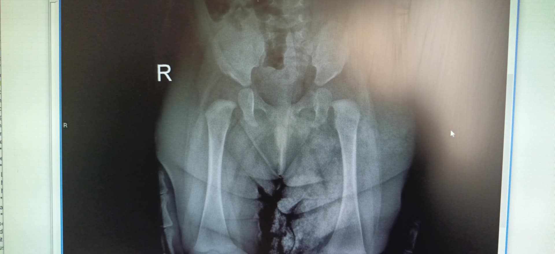 متى يجب عمل صورة خلع الولادة؟
