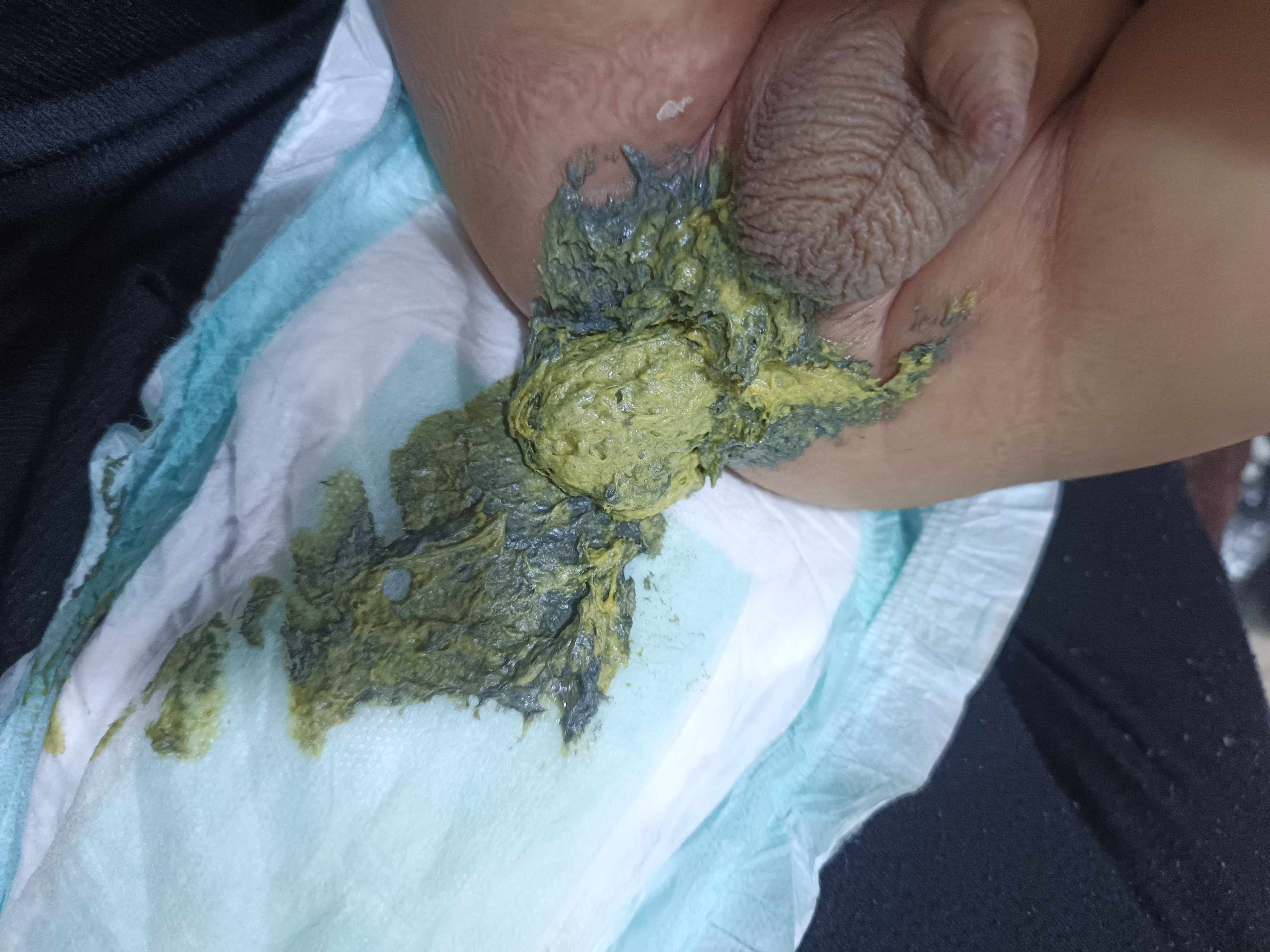 لون براز الرضيع اصفر مخضر