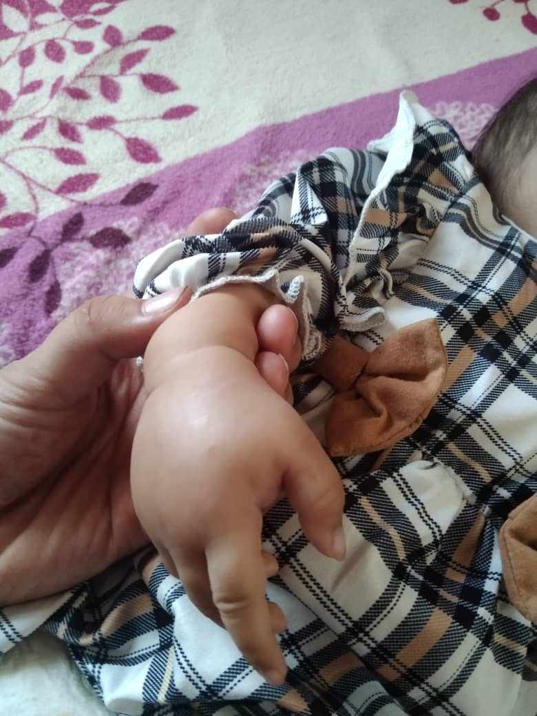 التهاب الاصابع عند الاطفال