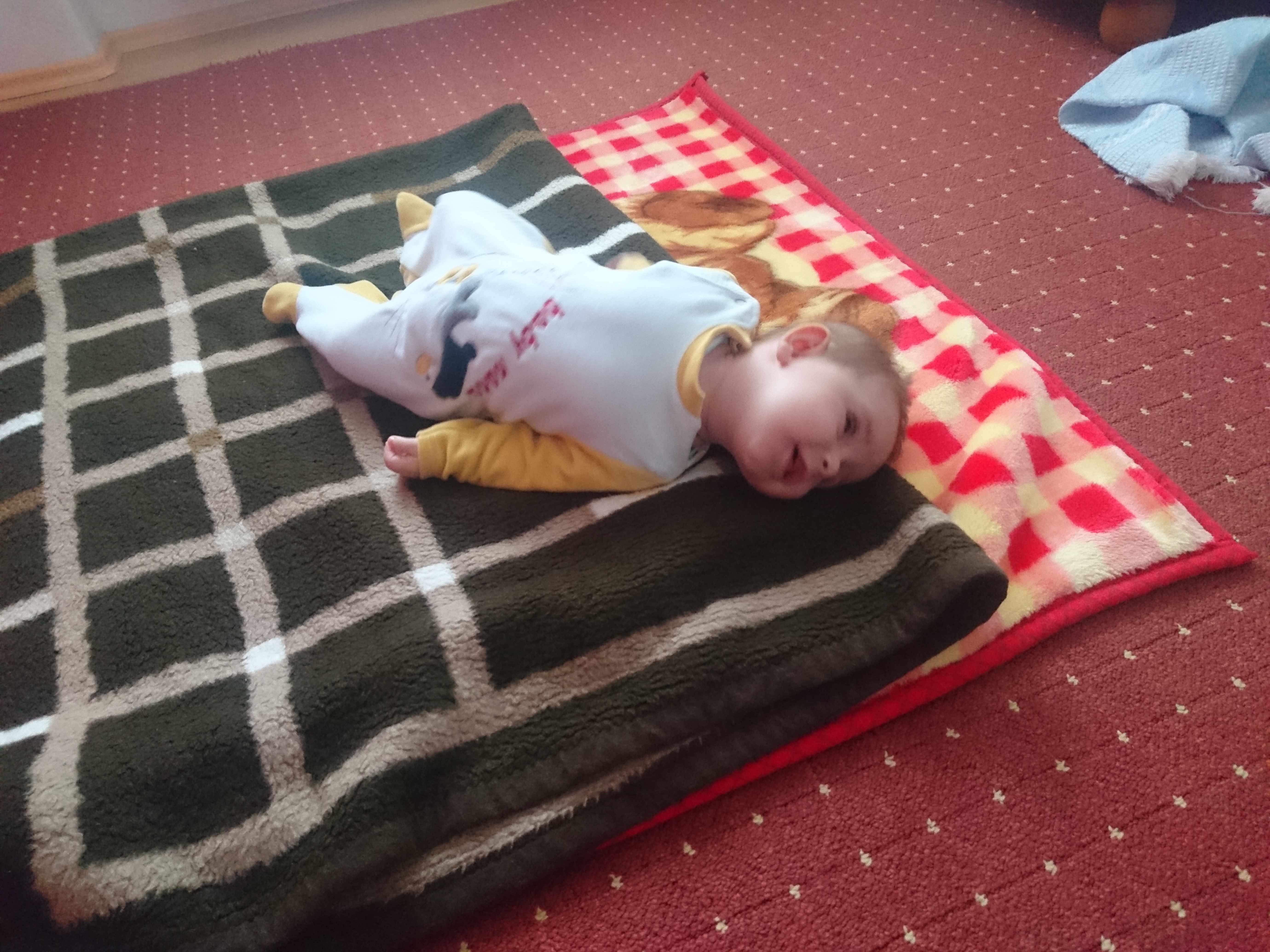تقوس دائم في ظهر و رقبة الطفل