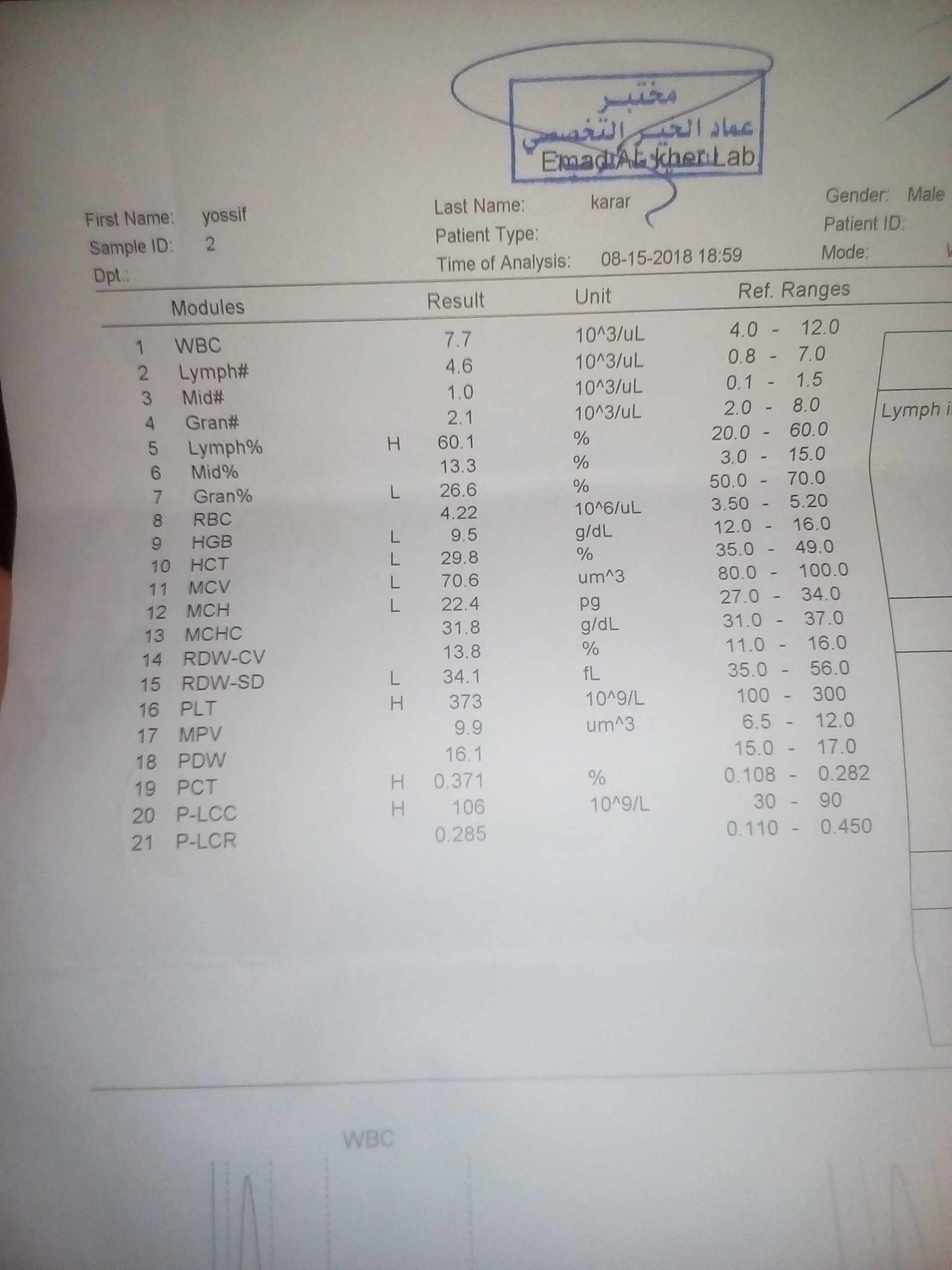 اصفرار و شحوب وجه الطفل