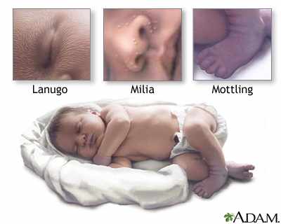 جلد الاطفال حديثي الولادة