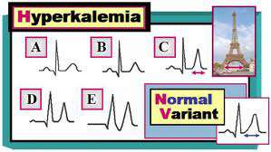 ارتفاع و فرط بوتاسيوم الدم عند الاطفال