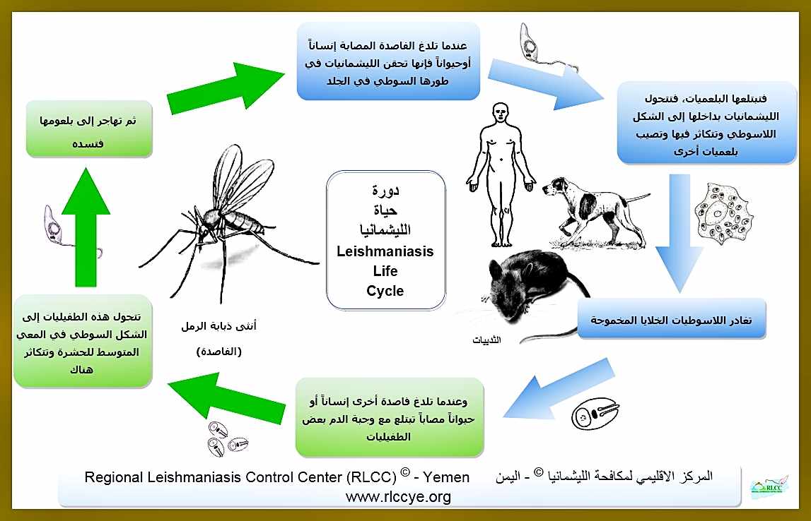 اسباب مرض الليشمانيا