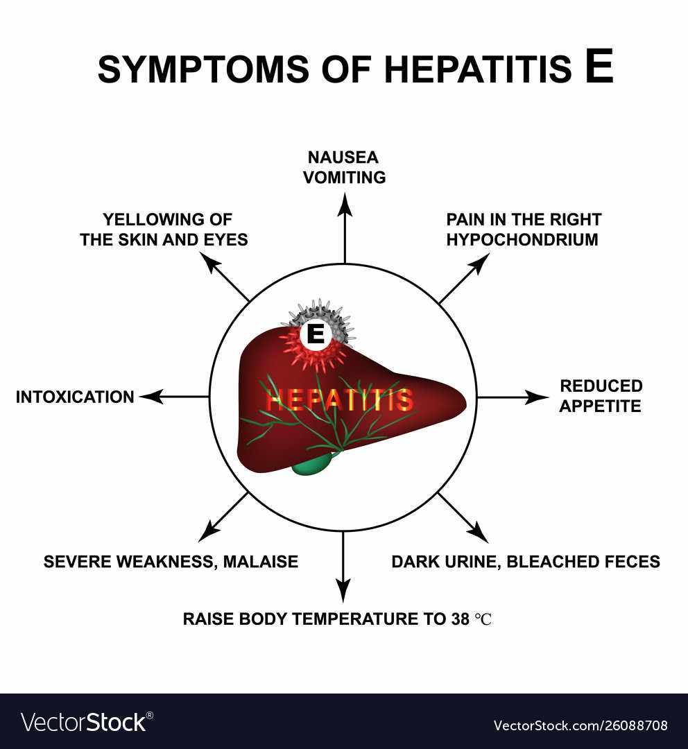 اعراض التهاب الكبد E