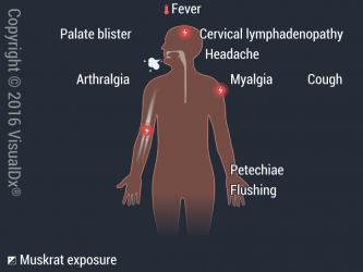 اعراض الحمى النزفية الفيروسية