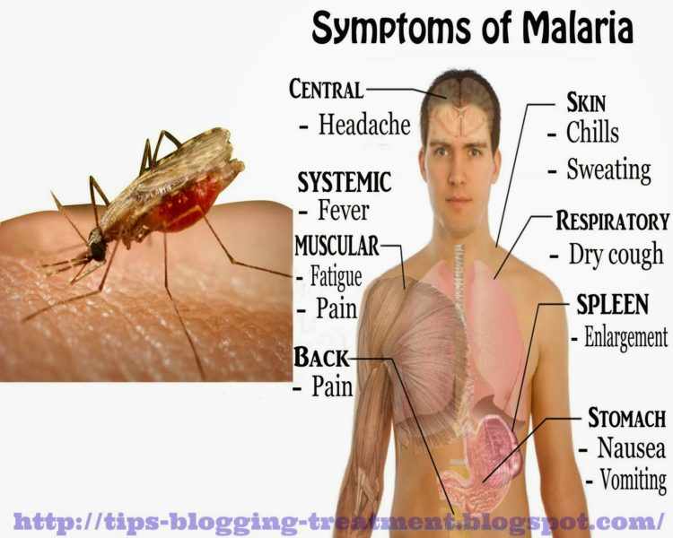 اعراض الملاريا عند الاطفال