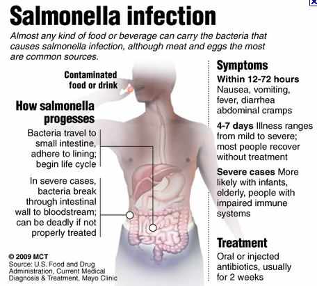 اعراض جراثيم بكتيريا السالمونيلا