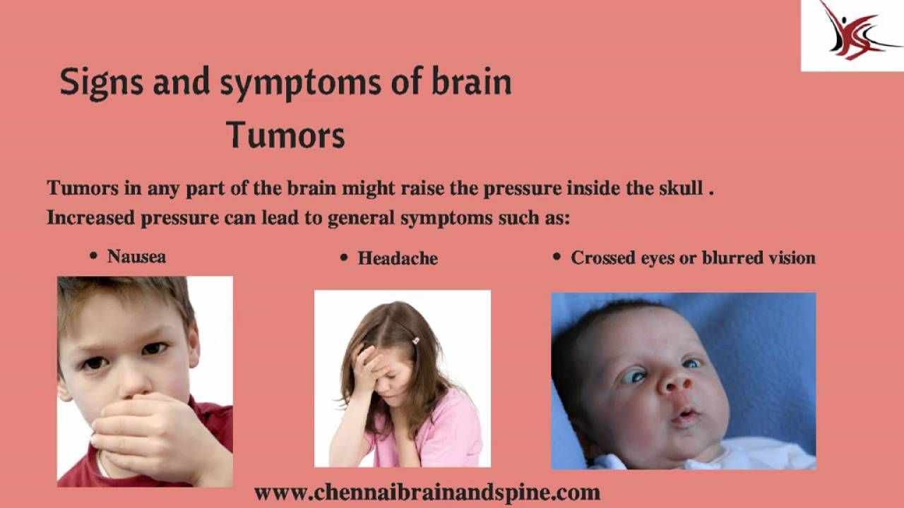 اعراض سرطان الدماغ عند الاطفال