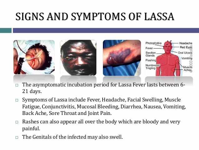 اعراض فيروس ارينا و حمى لاسا